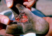 North West Intensifies Measures to Contain Foot and Mouth Outbreak Amid Spread in Ventersdorp Namibia detects a new strain of foot and mouth disease