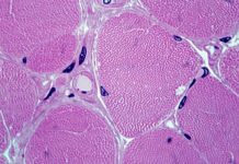 Technological milestone in the new food industry: GEA presents perfusion as key process at Anuga FoodTec